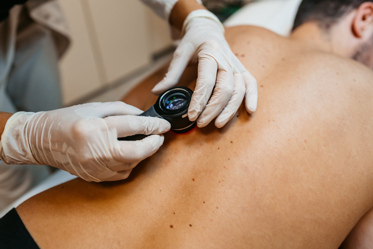 Man laying on stomach with doctor inspecting skin on back